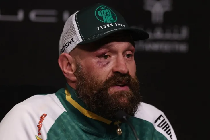 Fyuri-uning vazni haqida: qalin qorin bilan barchani mag'lub etdi