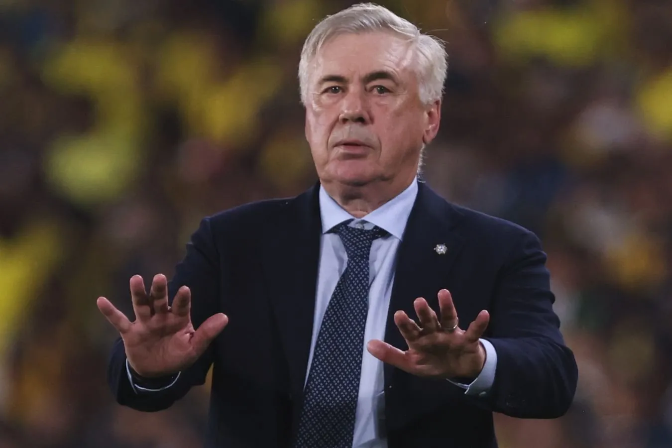 Anchelotti Ueslining jarohati haqida fikr bildirdi va mumkin bo'lgan futbolchilarni sanab o'tdi