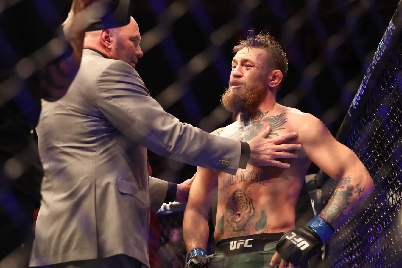 Konor Makgregor tizza operatsiyasi qanday o'tganini aytib berdi